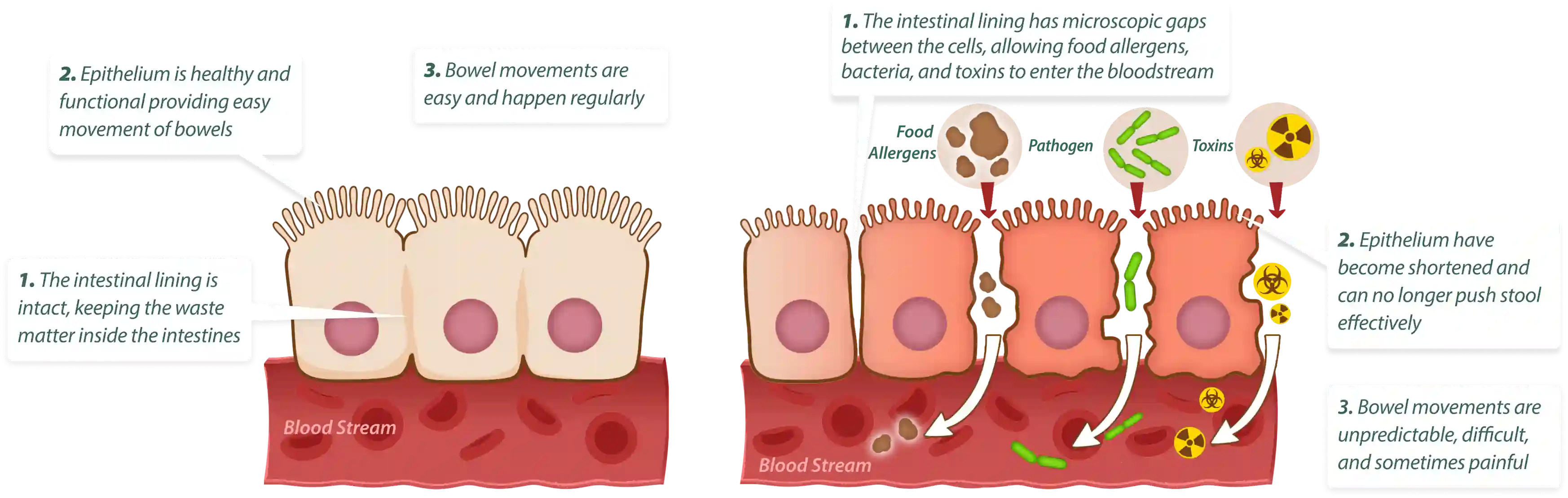 How Emma Supplement works – 3-step gut cleansing and healing process